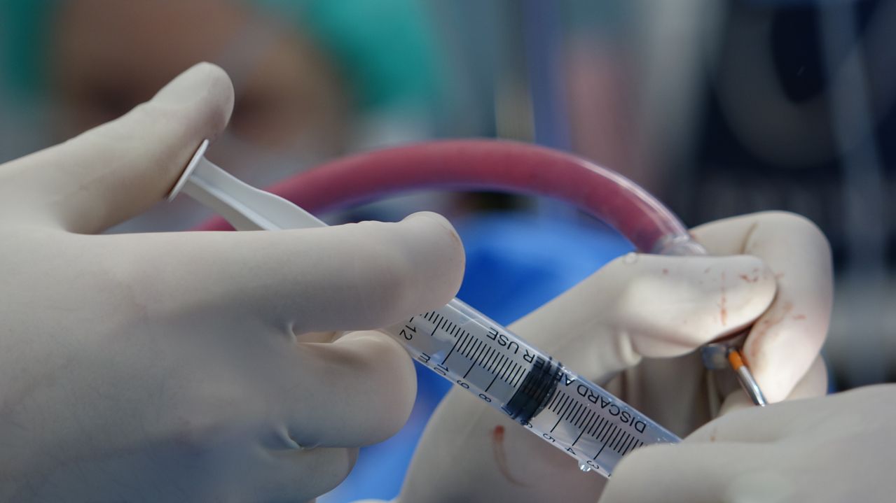 Aspiration Abortion Procedure and Safe Clinical Care