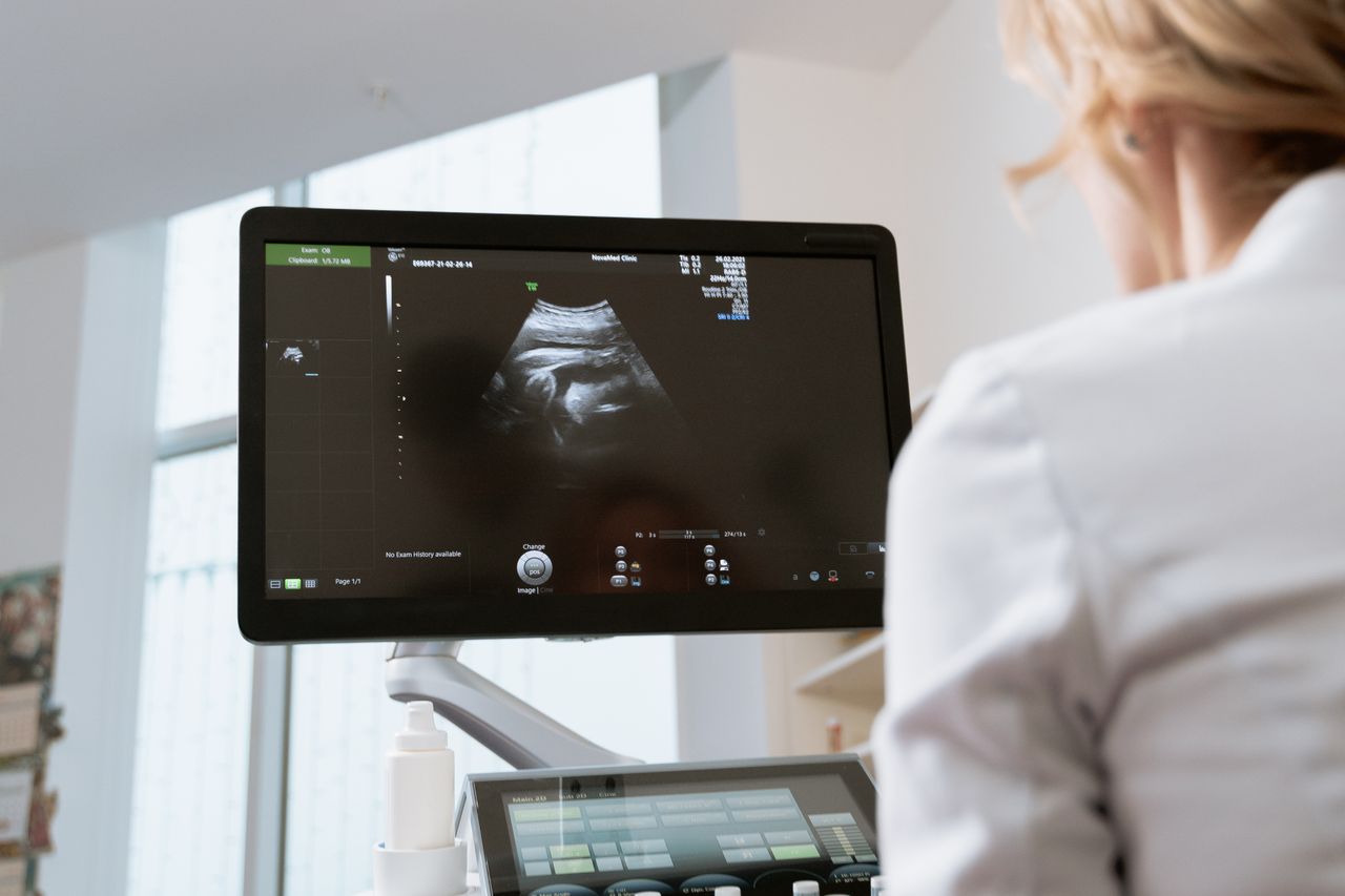 Obstetric Ultrasound Scan and Pregnancy Imaging Services